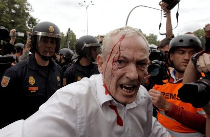 agresiones policiales en rodea el congreso 25s Madrid